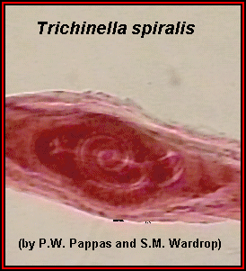 trichinella_larva2_3.gif