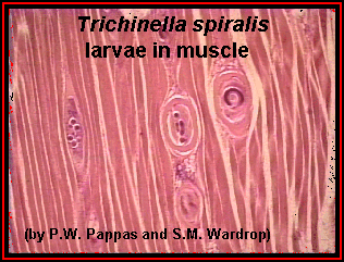 trichinella_larva_1.gif